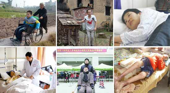 贵阳强直医院强直性脊柱炎导致瘫痪使得他们的生活处处不便.jpg